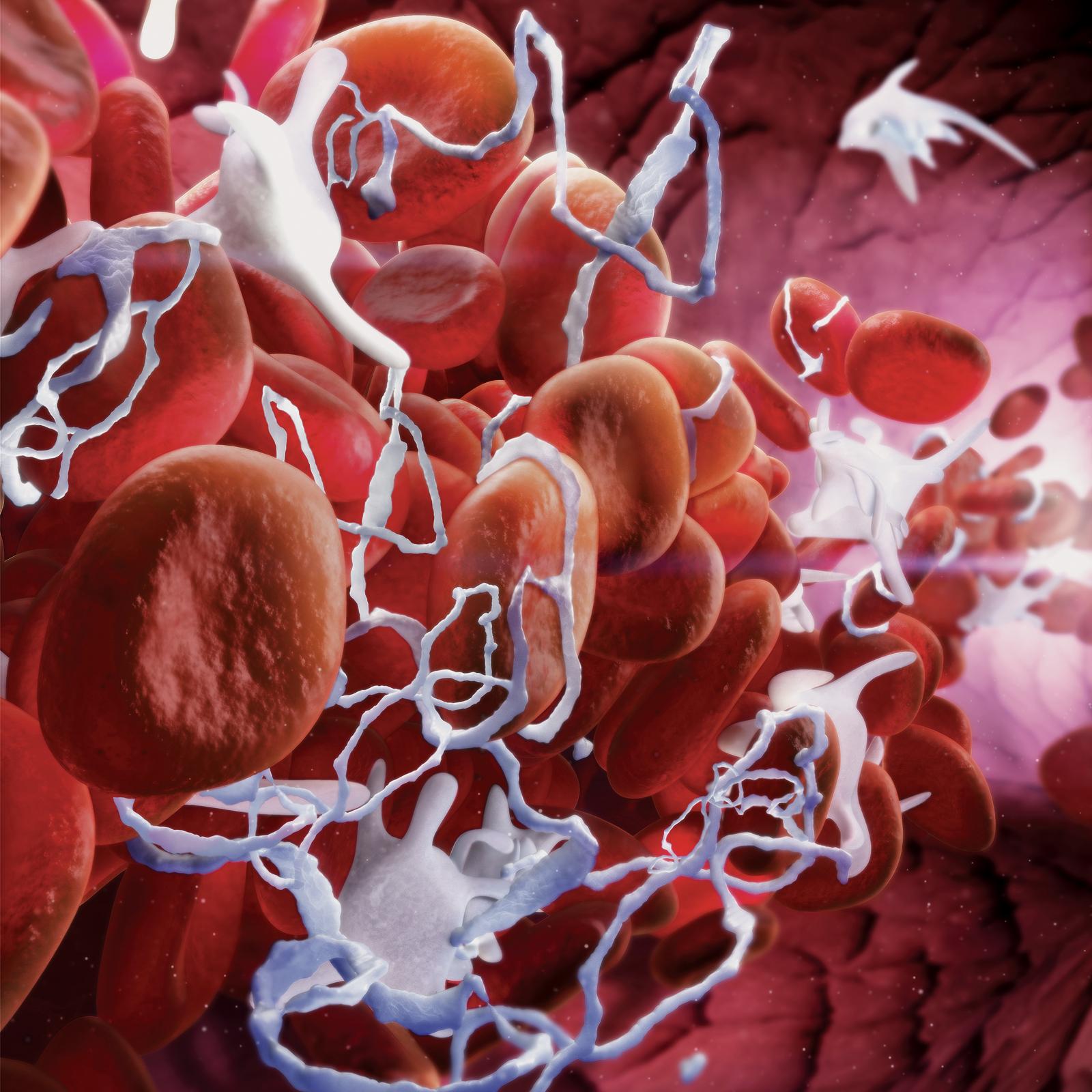 Alterations in biomarkers of cardiovascular disease in active ...